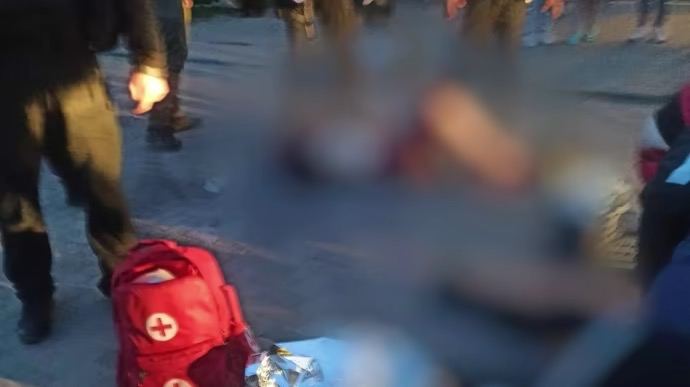 У Броварах Київської області внаслідок вибуху гранати поранено 2 людини